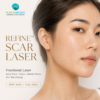 Refine Scar Laser Fractional Laser สำหรับหลุมสิว แผลเป็น รอยแตกลาย และ Skin Resurfacing PureAndBright