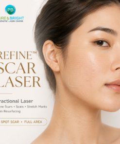 Refine Scar Laser Fractional Laser สำหรับหลุมสิว แผลเป็น รอยแตกลาย และ Skin Resurfacing PureAndBright