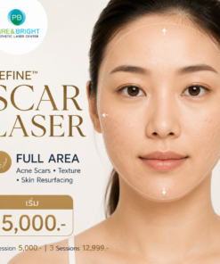 Refine Scar Laser Fractional Laser สำหรับหลุมสิวและแผลเป็นทั่วหน้า Full Area PureAndBright