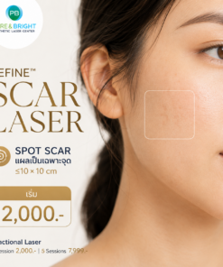 Refine Scar Laser เลเซอร์แผลเป็นเฉพาะจุด Spot Scar ไม่เกิน 10x10 ซม. PureAndBright