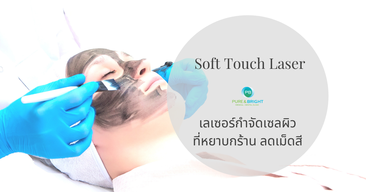 Soft touch Blemish eraser laser™ เลเซอร์หน้าใส ผิวเนียน ลดฝ้ากระ