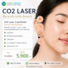 CO2 Laser จี้ไฝ ขี้แมลงวัน กระเนื้อ ติ่งเนื้อ เหมาทั่วหน้า PureAndBright