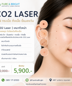 CO2 Laser จี้ไฝ ขี้แมลงวัน กระเนื้อ ติ่งเนื้อ เหมาทั่วหน้า PureAndBright