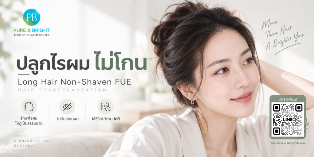 ภาพประกอบการปลูกผมไม่โกนด้วยเทคนิค Long Hair Non-Shaven FUE