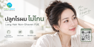 ภาพประกอบการปลูกผมไม่โกนด้วยเทคนิค Long Hair Non-Shaven FUE